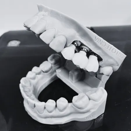 Modelo dental de impresión 3D