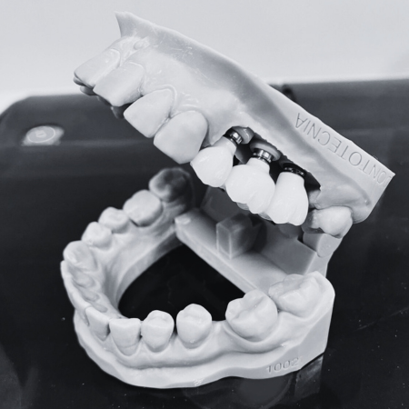 impresión 3d, laboratorio dental, proceso digital, odontotecnia